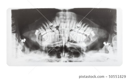 film with X-ray image of human jaws isolated 50551829