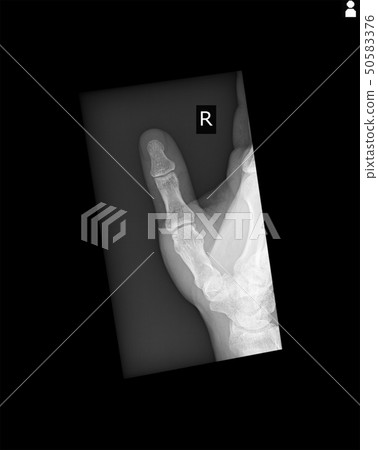 Roentgen 50583376