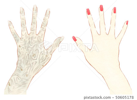 Sunburn and hand care Old hands and beautiful fingers after care Sunburn and hand care Old hands and beautiful fingers after care 50605178