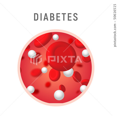 Blood sugar diabetes level concept icon symbol. Glucose insulin human desease Blood sugar diabetes level concept icon symbol. Glucose insulin human desease 50616515