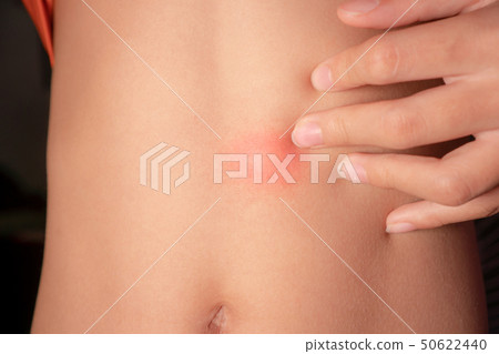 The boy was bitten by an ant. The boy was bitten by an ant. 50622440