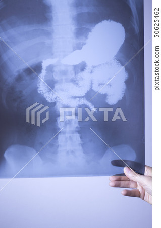 Medical xray spine hip scan 50625462