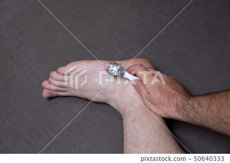 Man removing corn, callus from his feet using a razor file, masculine skin care, skin disease Man removing corn, callus from his feet using a razor file, masculine skin care, skin disease 50640333