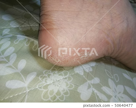 Gagasasa of the heel 50640477