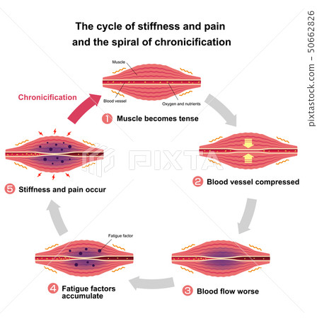 Stiff neck and pain cycle and chronic process... - Stock Illustration ...