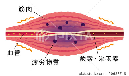 Illustration of fatigued muscles / Shoulder stiffness / stiffness / pain 50687748