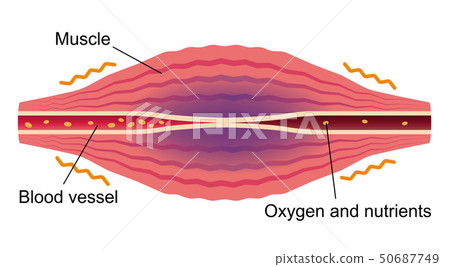 Muscles that became oxygen and undernourished due to deterioration of blood flow (English) / Shoulder stiffness, stiffness, pain Muscles that became oxygen and undernourished due to deterioration of blood flow (English) / Shoulder stiffness, stiffness, pain 50687749