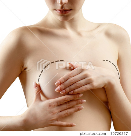 Plastic surgery for female breast correction. 50720257