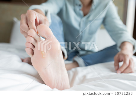 applying cream for athletes foot applying cream for athletes foot 50751283