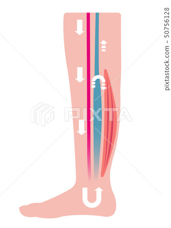 Cause / process of swelling of the leg (edema) Illustration / Elevated venous pressure due to fluid stagnation (without letter) Cause / process of swelling of the leg (edema) Illustration / Elevated venous pressure due to fluid stagnation (without letter) 50756128