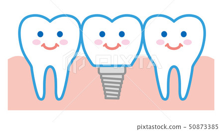 Tooth implant illustration 50873385