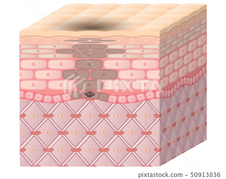 Skin cross section (blot) 50913836