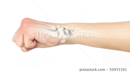 wrist bones injury white background wrist pain 50935391
