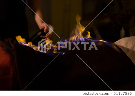 Chinese fire massage and therapy Chinese fire massage and therapy 51137886