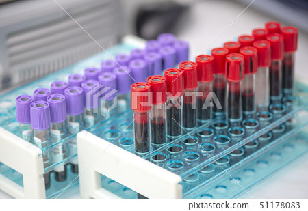 Tubes of blood sample for testing 51178083