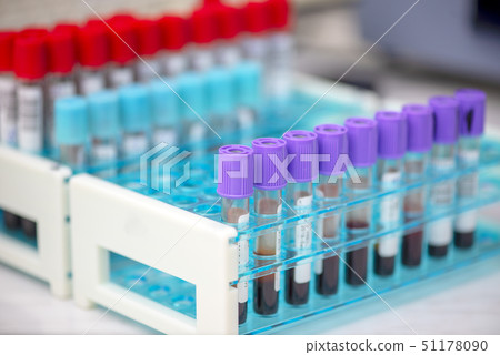 Tubes of blood sample for testing 51178090