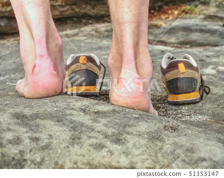 Man hiker legs without trousers and hiking boots Man hiker legs without trousers and hiking boots 51353147