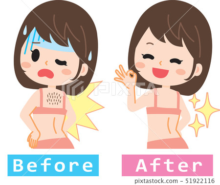 患有背毛的女性 51922116