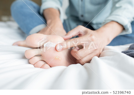 applying cream for athletes foot applying cream for athletes foot 52396740