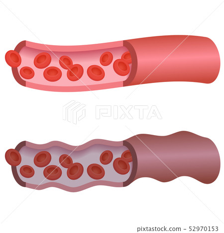 Blood vessel 52970153
