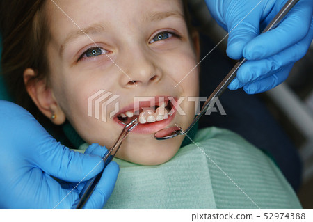 Little girl at dentist on examination. Little girl at dentist on examination. 52974388