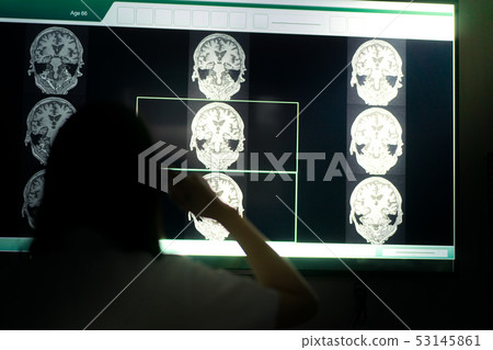 MRI indicated Dementia MRI indicated Dementia 53145861