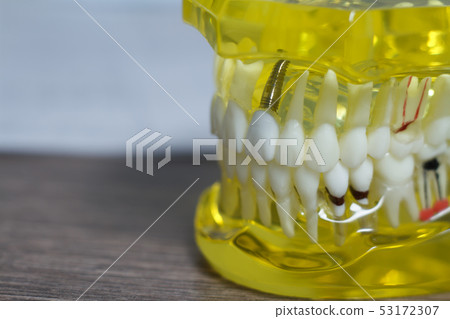 The dental tooth dentistry student learning 53172307