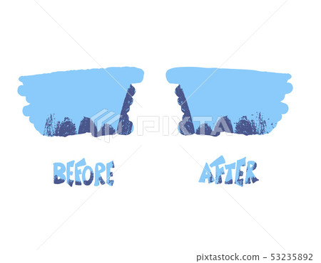 Before and after template. Vector screen elements.-插圖素材 