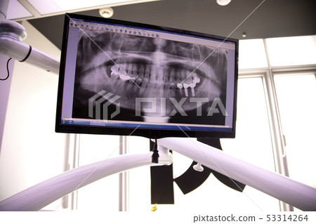 Dental X-ray floating on dental monitor Dental X-ray floating on dental monitor 53314264