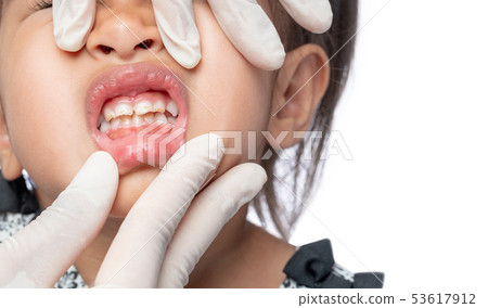 The dentist is examining the baby's teeth. The dentist is examining the baby's teeth. 53617912