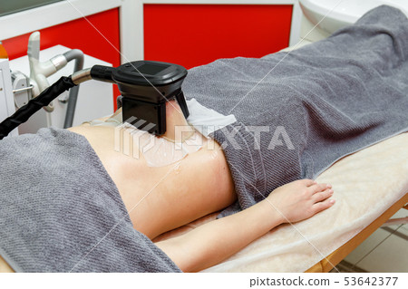 Weight loss and slimming cryolipolysis treatment 53642377