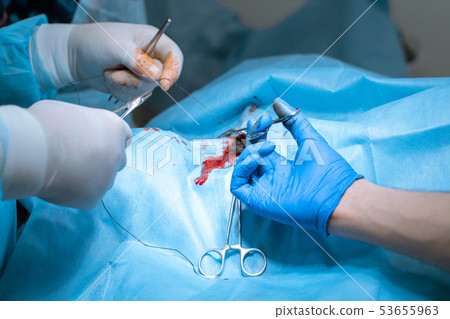 the surgeon applies a surgical clamp to stop the 53655963