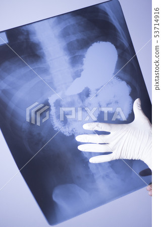 Medical xray spine hip scan Medical xray spine hip scan 53714916