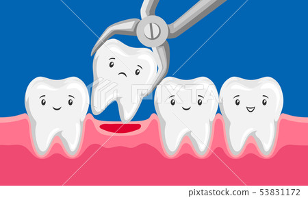 Illustration tooth is removed by forceps in oral cavity. Illustration tooth is removed by forceps in oral cavity. 53831172