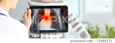 Female medic examining little girl with ultra modern scanning tablet pc showing pulmonology problems Female medic examining little girl with ultra modern scanning tablet pc showing pulmonology problems 53884231