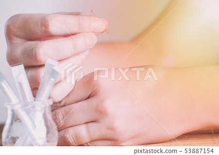 Hand applying acupuncture needle Hand applying acupuncture needle 53887154