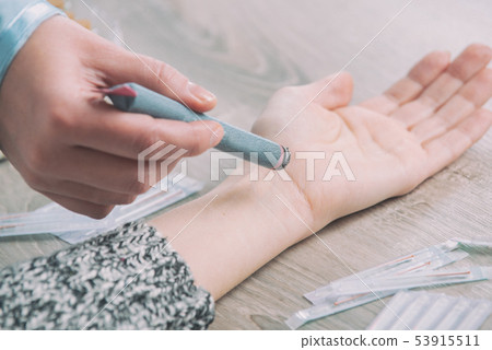 Therapist doing moxa treatment 53915511