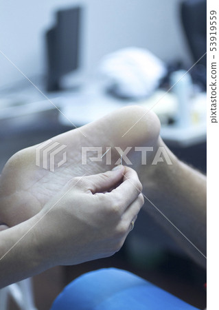 EPI dry needling physiotherapy 53919559