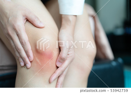 bruised knee of asia woman, selective focus 53942739