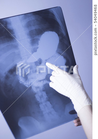 Medical xray spine hip scan 54049468