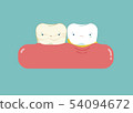 Calculus teeth cartoon, dental concept. 54094672