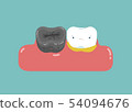 Bad teeth with problem, decay, plague, dental  54094676