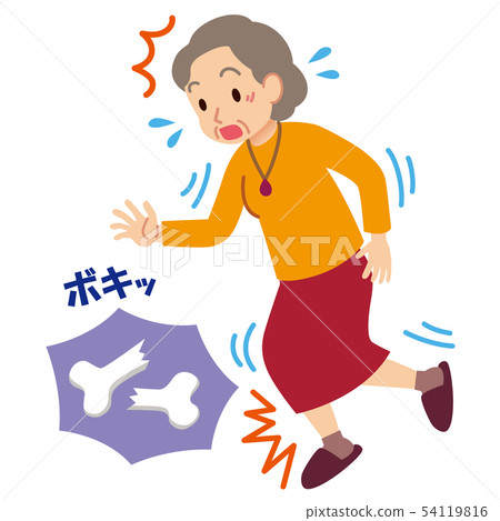 Elderly people's fractures osteoporosis 54119816