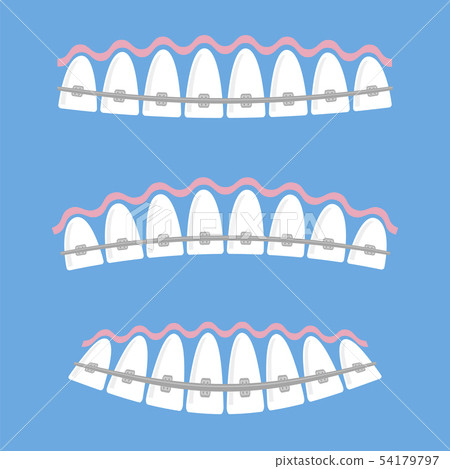 Medical Braces Teeth. Dental Care Background. Orthodontic Treatment. Cartoon Opening Mouth 54179797