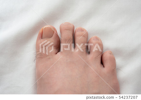 在圖像之前男士的腳趾脫毛 54237207