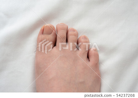 在圖像之前男士的腳趾脫毛 54237208