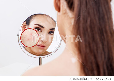 Young woman with acne skin in red aim. 54272593