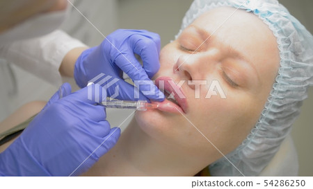 Lip injection, operation to increase the volume of the lips. doctor cosmetologist makes contouring 54286250