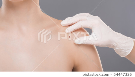 Dermatologist examining birthmark on woman shoulder, panorama Dermatologist examining birthmark on woman shoulder, panorama 54447326