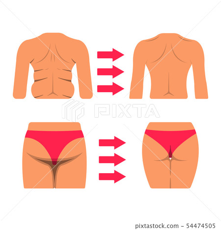 Set of White Woman Body Part. Fat and Sporty Body 54474505